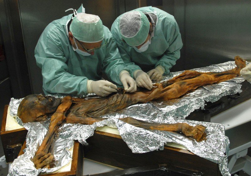 In this November 2010 photo provided by the South Tyrol Museum of Archaeology, researchers examine the body of a frozen hunter known as Oetzi the Iceman to sample his stomach contents in Bolzano, Italy. In a report released on Thursday, July 12, 2018, scientists said the analysis offers a snapshot of what ancient Europeans ate more than five millennia ago. (Marco Samadelli/Eurac/South Tyrol Museum of Archaeology via AP)