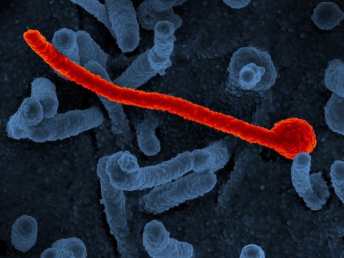 Ebola cases climb to 100 in latest DR Congo outbreak