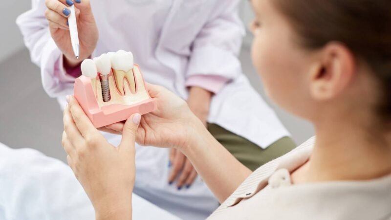 Misconceptions Patients Have About Dental Implants